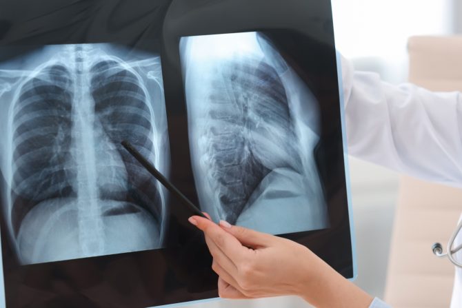 tri problema sa očima