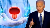 Džo Bajden ima agresivni rak prostate i metastaze na kostima: Koji su simptomi i kakve su prognoze?