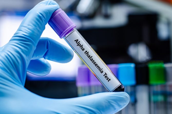 alfa talasemija