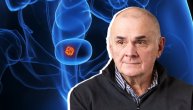 Ako se otkrije kasno, karcinom mokraćne bešike je agresivna i smrtonosna bolest: Urolog o prvim simptomima i navici koja povećava rizik
