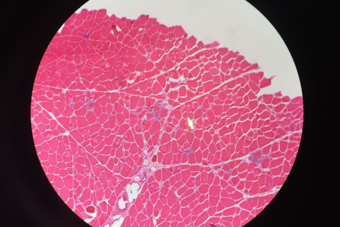 vidljivi znaci na šakama