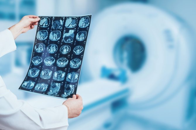 mladi vtri vrste raka