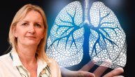 Teška astma ne treba da se leči oralnim kortikosteroidima jer oni mogu da dovedu do nastanka drugih udruženih i teških bolesti, poručuje dr Sanja Hromiš