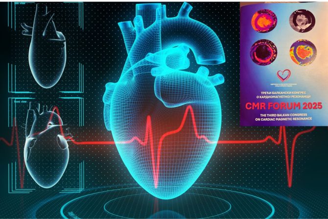 kardiomagnetna rezonanca