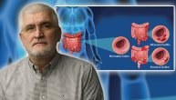 Dr Dino Tarabar: Bol, krvarenje, nemogućnost odlaganja pražnjenja – tako izgleda svaki dan ako imate zapaljensku bolest creva
