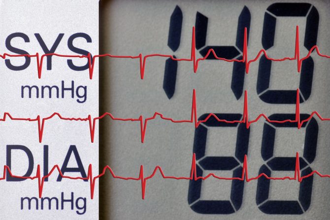 novi način merenja krvnog pritiska