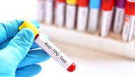 Šta kad test na antitela pokaže povišene vrednosti: Anti-TPO test