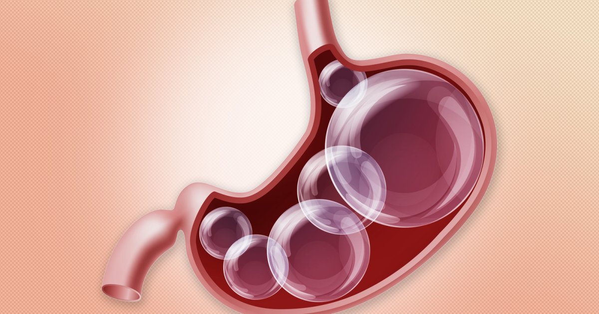 Ispuštanje gasova je neprijatna pojava koja se teško kontroliše, ima li ...