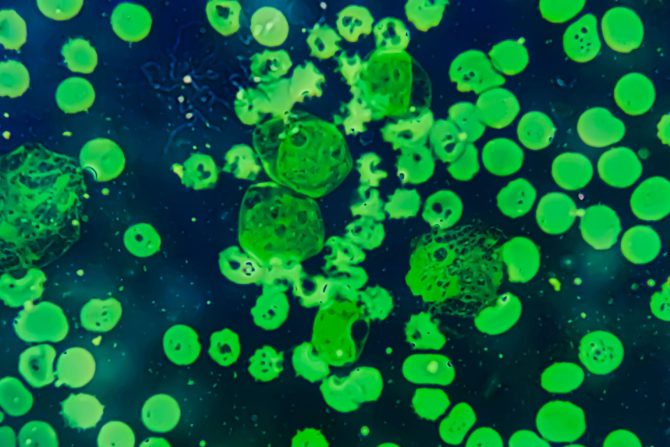 Agresivan tip raka krvi