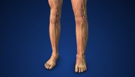 Otok nogu ili ruku nekada je posledica neizlečivog limfedema, može li da pomogne limfna drenaža