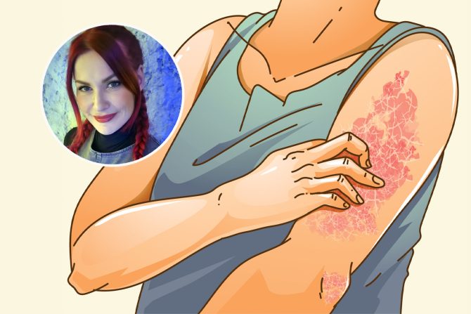 Koža ishrana i bolesti