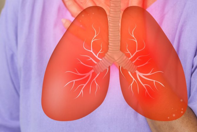 ispitivanje vakcine protiv raka pluća