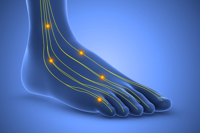 dijabetička neuropatija