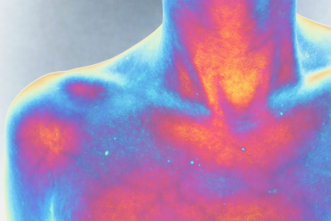 visoke temperature onkološki pacijenti