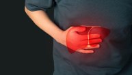 Simptomi jedne infekcije jetre liče na grip: Kako se prenosi virus koji je izaziva i da li je opasan?