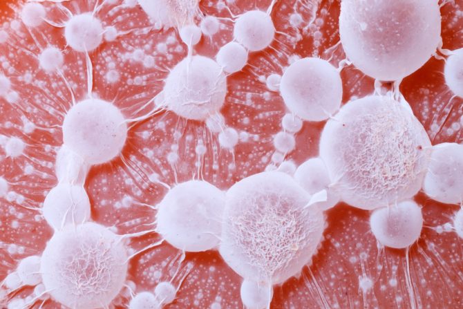 uspavane ćelije raka dojke