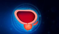 Čak i kada je označen kao prvi stadijum, rak prostate nosi veći rizik nego što biopsija pokazuje