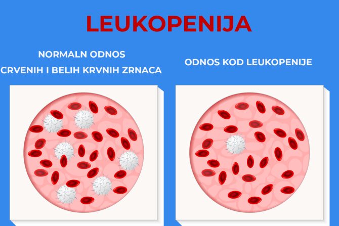 Leukopenija
