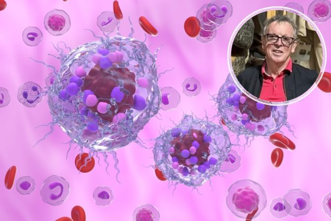 neuroendokrini tumori