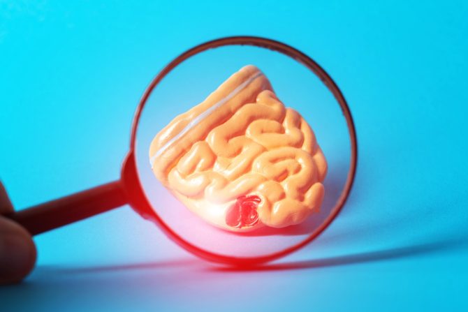 poremećaj Motiliteta