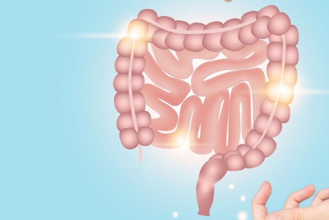 kolorektalni karcinom