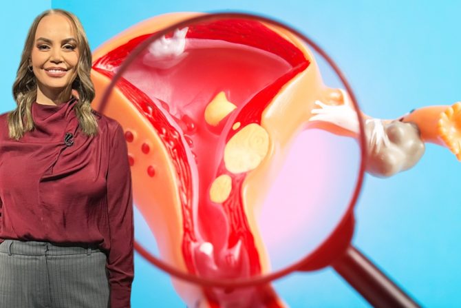 miom materice fibroid jelena dokić teniserka