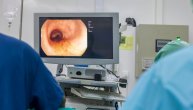 Da li i za koga kolonoskopija može da bude rizičan pregled