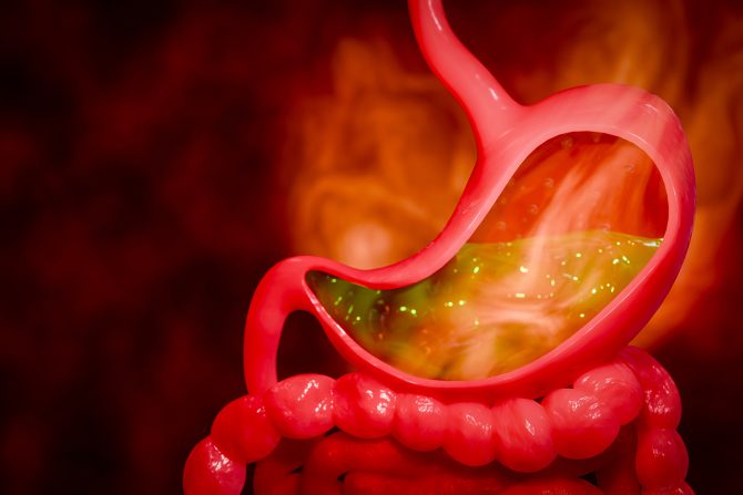 želudačna kiselina