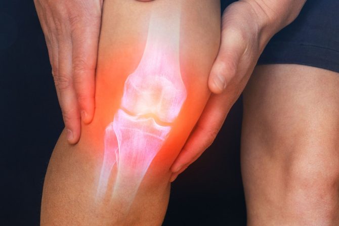 veštačka hrskavica