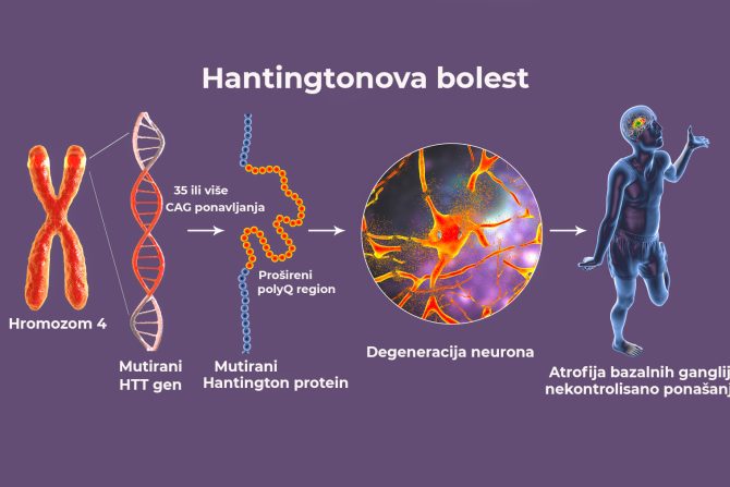 Hantingtonova bolest