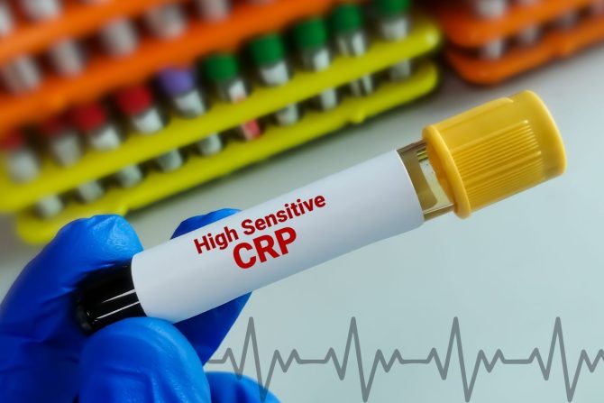hsCRP test