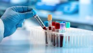 Da li novi test krvi zaista može da otkrije mijalgični encefalomijelitis, poznatiji kao sindrom hroničnog umora?