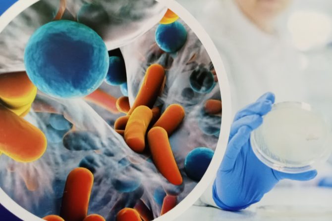 bakterijskih infekcija