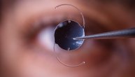 Implantat za oči omogućio da slepi pacijenti ponovo čitaju i pišu