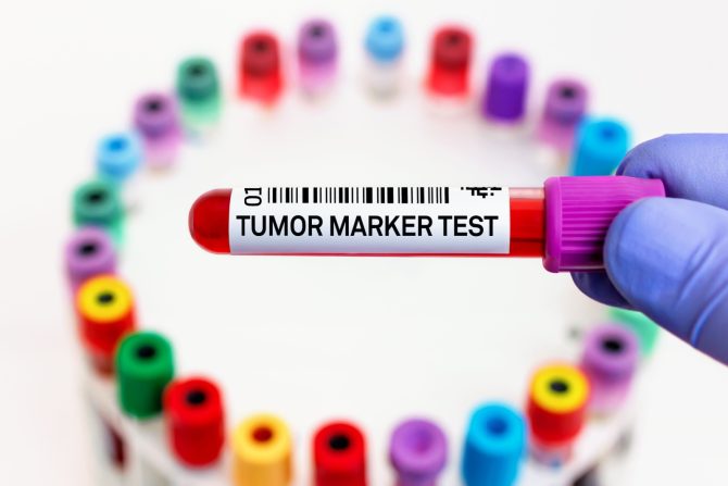 tumor marker