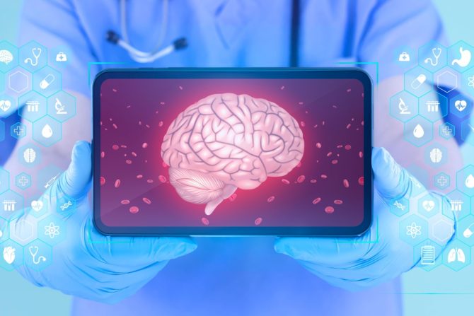 marker-test za alchajmerovu bolest