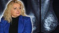 I najagresivnija forma karcinoma dojke otkrivena u samom startu se uspešno leči: Dr Ivana Minić o imunoterapiji, prognozama i prevenciji