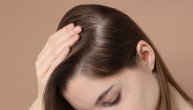 Naučnici kažu da imaju revolucionaran lek protiv gubitka kose: Tretman traje 20 dana