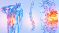 Šta sve može da izazove iznenadni bol u donjem delu leđa