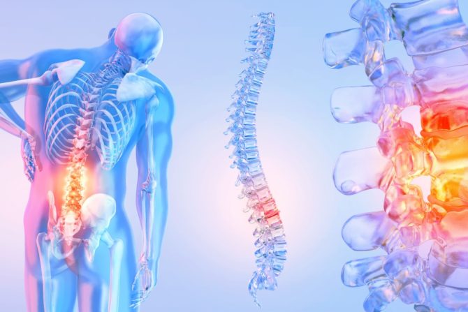 iznenadni bol u donjem delu leđa