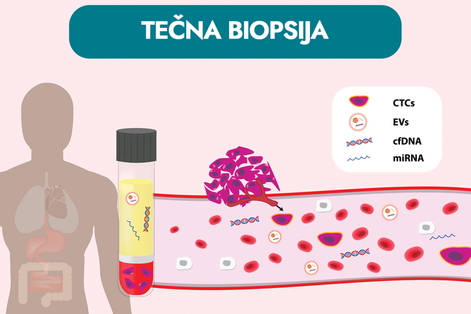 test tečne biopsije