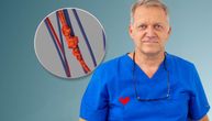 Zašto digitalni umor najbrže oštećuje vene: otkriva dr Dario Jocić