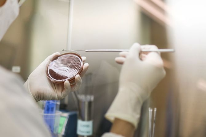 infekcije, testiranje