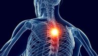 Kada je za bol u torakalnom delu kičme uzrok neko ozbiljnije stanje i kako da ga umanjite