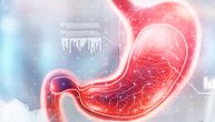 Unutrašnja obloga želuca veoma je kompleksna, zato se i rak želuca teško otkriva u ranoj fazi