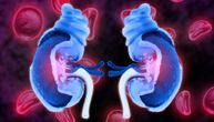 Hronična bolest bubrega „truje” srce pacijenta, otkrili su naučnici i objasnili kako se to dešava