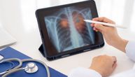 Rana dijagnoza raka pluća kroz skrining program omogućava pacijentima realnu šansu za izlečenje