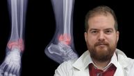 Šta ne sme da radi pacijent koji je doživeo prelom skočnog zgloba, čitaoce savetuje fizioterapeut Filip Pavčič