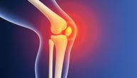 Zašto boli koleno, a niste se povredili? Najčešći uzroci koje zanemarujemo