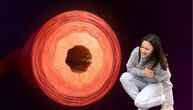 Srčani udar kod žena može nastati i kada arterije nisu „jako zapušene“: studija menja procenu rizika